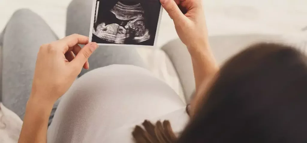 femme enceinte allongée tenant dans ses mains l'echographie de son bébé accouchement après terme